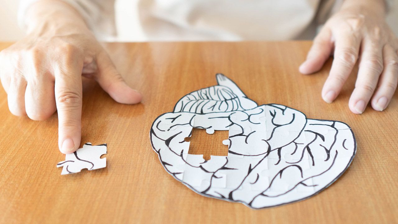 Alzheimer’s Disease